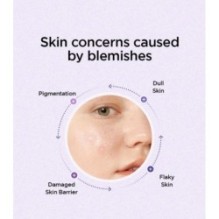 Isntree - Onion Newpair B5 Ampoule