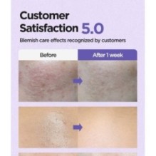 Isntree - Onion Newpair Clear Pad