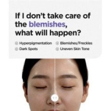 Isntree - Onion Newpair Clear Pad