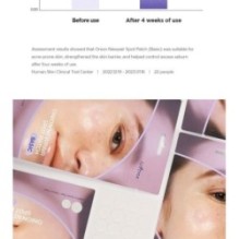 Isntree - Onion Newpair Spot Patch Basic