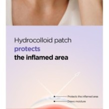 Isntree - Onion Newpair Spot Patch Basic