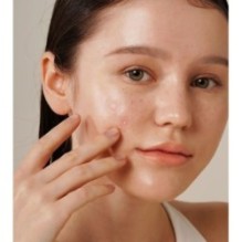 Isntree - Onion Newpair Spot Patch Basic