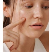 Isntree - Onion Newpair Spot Patch Skin Fit