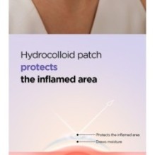 Isntree - Onion Newpair Spot Patch Skin Fit