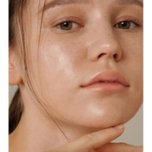 Isntree - Onion Newpair Spot Patch Skin Fit