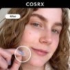 COSRX - Acne Pimple Master Patch