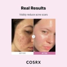 COSRX - The Niacinamide 15 Serum