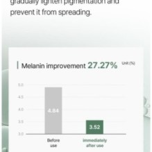 mixsoon - Premium Galactomyces Serum