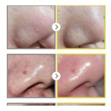 numbuzin - No. 1 Easy Peasy Cleansing Oil