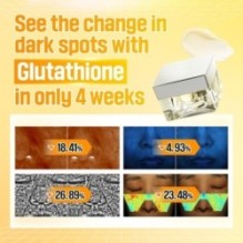numbuzin - No. 5 Vitamin Glutathione Dark Spot Laser Cream
