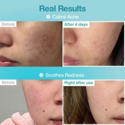 numbuzin - No.1 Pantothenic B5 Hyaluronic Active Clear Mask Set 10 sheets