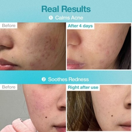 numbuzin - No.1 Pantothenic B5 Hyaluronic Active Clear Mask Set 10 sheets