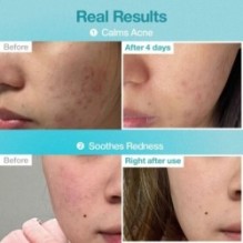 numbuzin - No.1 Pantothenic B5 Hyaluronic Active Clear Mask Set 5 sheets