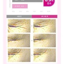 CKD Guaranteed - Retino Collagen Small Molecule 300 Glow Stick