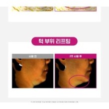 CKD Guaranteed - Retino Collagen Small Molecule 300 Guasha Neck Cream Refill Only