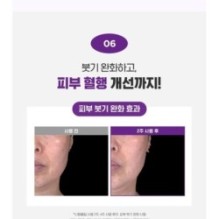 CKD Guaranteed - Retino Collagen Small Molecule 300 Neck Guasha Cream Filltocshot Refill Only