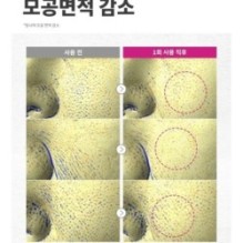 CKD Guaranteed - Retino Collagen Small Molecule 300 Pore Cleansing Foam