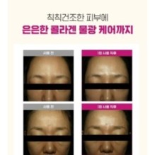 CKD Guaranteed - Retino Collagen Small Molecule 300 Tightening Cream Pack Set