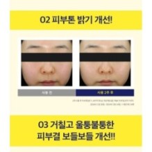 CKD Guaranteed - Vita C Teca Blemish Shot Mask Set