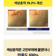 CKD Guaranteed - Vita C Teca Triple Blemish Patch