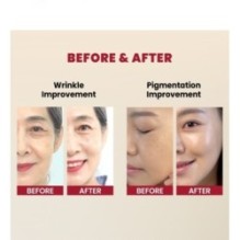 KSECRET - SEOUL 1988 Serum : Retinal Liposome 2% + Black Ginseng