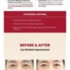 KSECRET - SEOUL 1988 Eye Cream : Retinal Liposome 4% + Fermented Bean