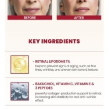 KSECRET - SEOUL 1988 Cream : Retinal Liposome 1% + Fermented Rice