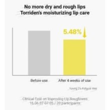 Torriden - SOLID IN Ceramide Lip Essence