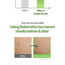 Torriden - Balanceful Trial Kit