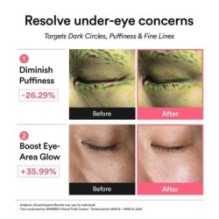 Abib - PDRN Retinal Eye Patch Glow Jelly