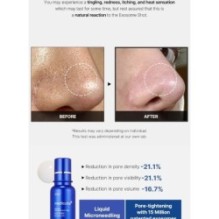 medicube - One Day Exosome Shot Pore Ampoule 7500