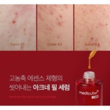 medicube - Red Acne Succinic Acid Peel