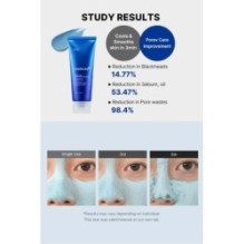 medicube - Zero Pore Blackhead Mud Mask