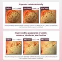 Centellian24 - Madeca Mela Capture Ampoule Pad