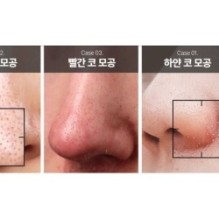 Centellian24 - Madeca Real Green Pore Nose Pack