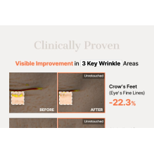 COSRX - 5 PDRN Hyaluronic Acid Vital Hydrating Hydrogel Mask 34g