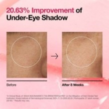 Anua - Niacinamide 5 TXA Brightening Pad