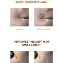 SKIN 1004 - Madagascar Centella Probio-Cica Bakuchiol Eye Cream Twin Pack Set