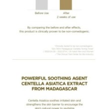 SKIN 1004 - Madagascar Centella Toning Toner