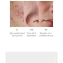 SKIN 1004 - ZOMBIE BEAUTY Cocoon Soap Mask