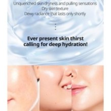 VT - Hydrop Reedle Shot 300hL