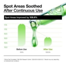 Anua - Azelaic Acid 10 Hyaluron Redness Soothing Serum