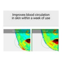 VT - Reedle Shot 100