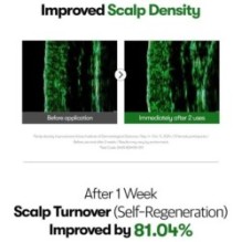 VT - PDRN Reedle Shot Hair Ampoule 100dL