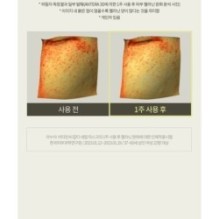 Anua - Vitamin C Blemish Serum Mask Set